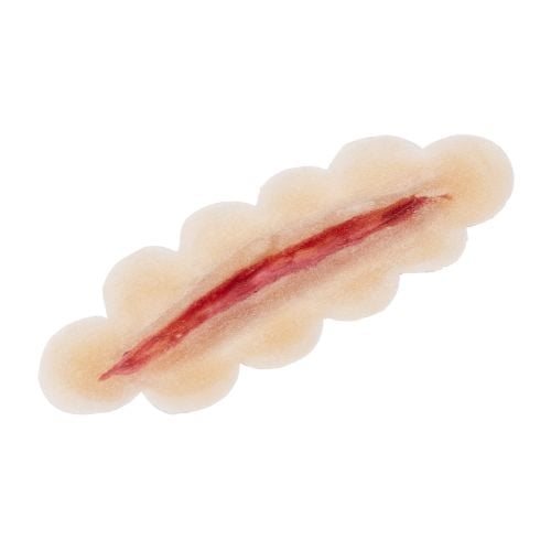 Latex applicatie small scar